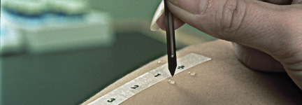 Starmed Tıbbi Ürün